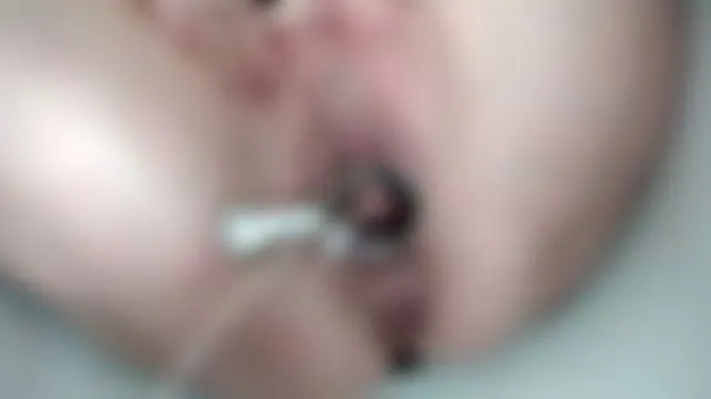 Spekulumpiss